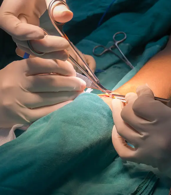 Mammoplasty in Seoul, South Korea by Asan Medical Center — Procedure Gallery Photo