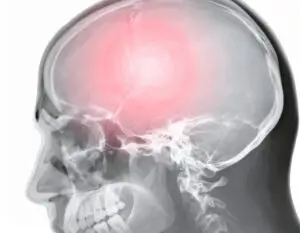 Epilepsy Treatment Clinics and Procedures Abroad