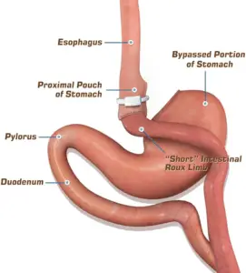 Fobi-Capella Surgery Clinics and Procedures Abroad