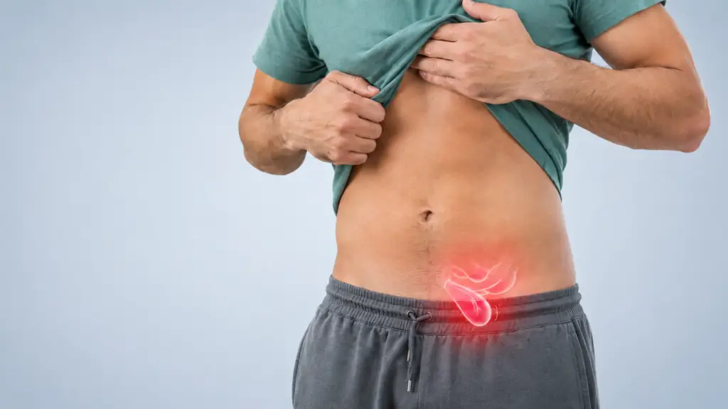 Pilonidal Cyst Surgery in São Paulo, Brazil by Kaiser Clínica — General Surgery Procedure in Brazil