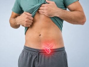 Pilonidal Cyst Surgery in São Paulo, Brazil by Kaiser Clínica — General Surgery in Brazil