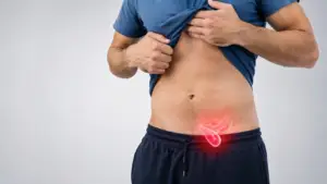 Hernia Surgery in Istanbul, Turkey by Avicenna Hospital at Avicenna Hospital — General Surgery Procedure Abroad