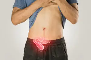 Abdominal Wall Hernia Surgery in Istanbul, Turkey by Avicenna Hospital