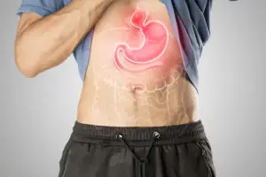 Hiatal Hernia Surgery Clinics and Procedures Abroad