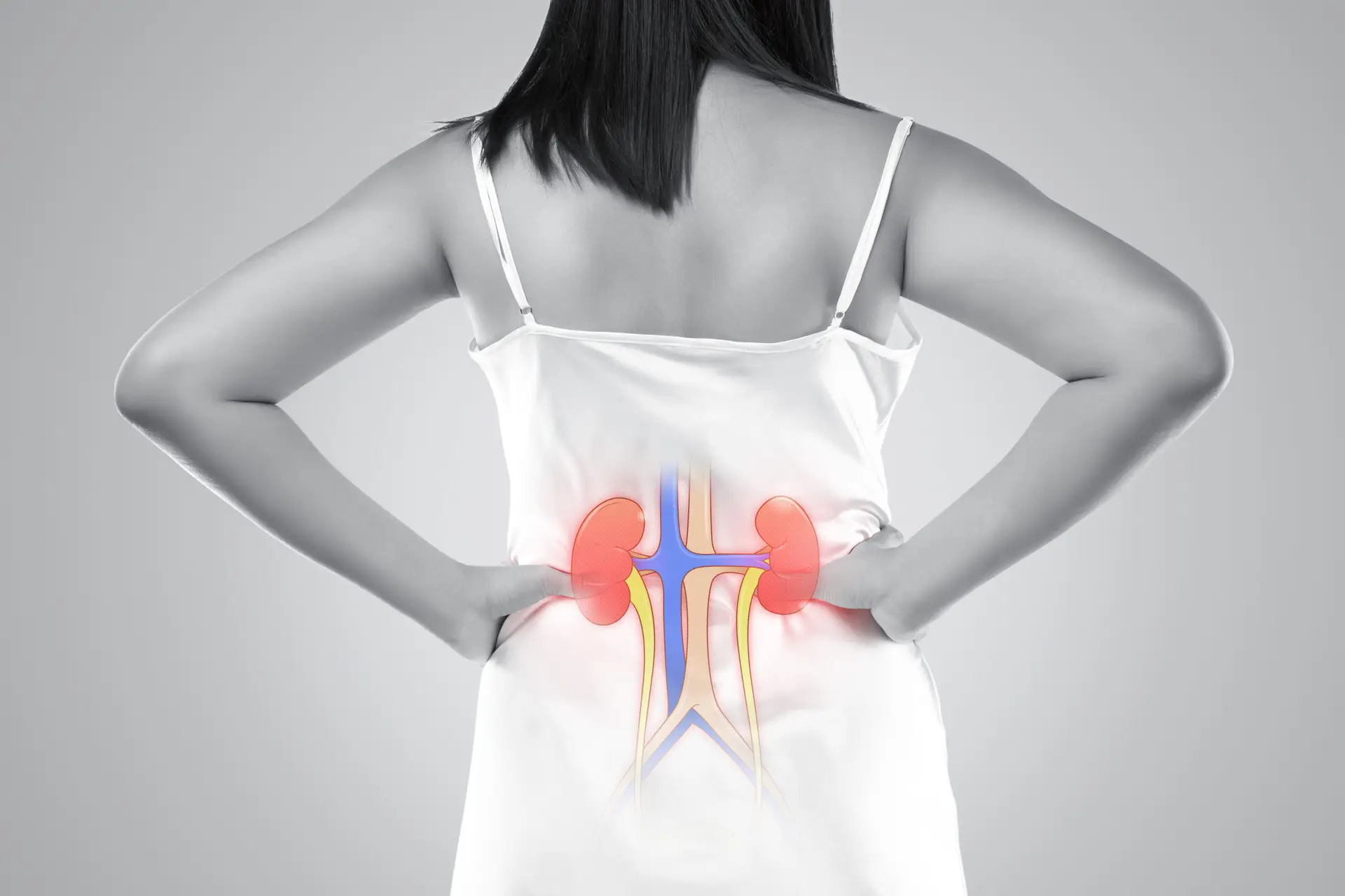 Kidney Cancer Treatment in Istanbul, Turkey by Avicenna Hospital — Procedure Gallery Photo
