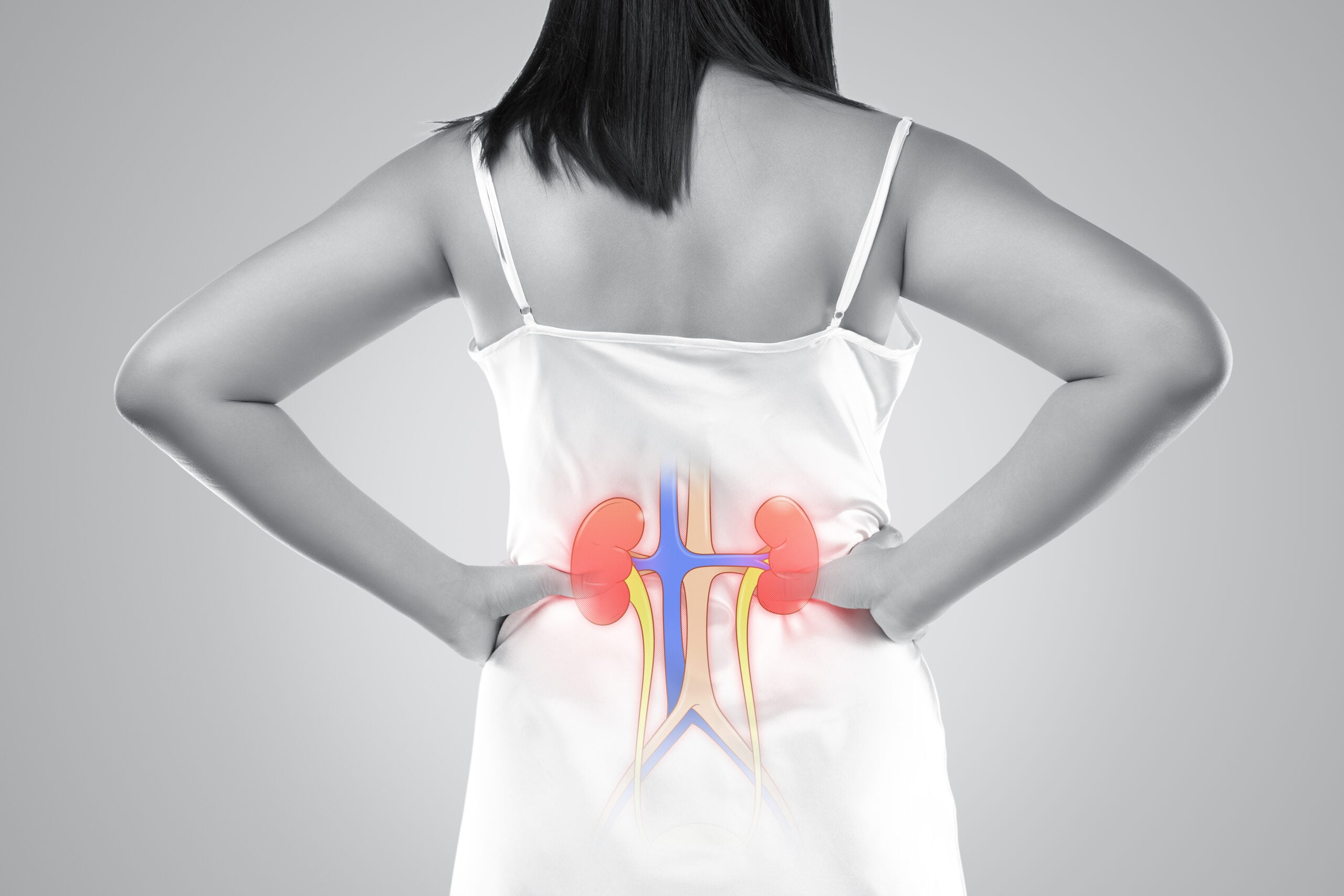 Polycystic Kidney Disease Treatment in Istanbul, Turkey by Avicenna Hospital — Procedure Gallery Photo