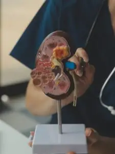 Kidney Cancer Treatment in Istanbul, Turkey by Avicenna Hospital