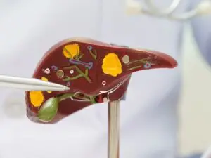 Cirrhosis of the Liver Treatment with Stem Cells in Malacky, Slovakia by CellCenter Slovakia — Stem Cell Treatment in Slovakia