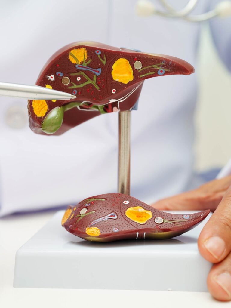 Cirrhosis of the Liver Treatment with Stem Cells in Malacky, Slovakia by CellCenter Slovakia — Hepatology Procedure in Slovakia