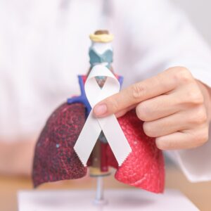 Lung Cancer Treatment in Istanbul, Turkey by Avicenna Hospital at Avicenna Hospital — Oncology Procedure Abroad