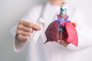 Lung Cancer Surgery in Seoul, South Korea by Asan Medical Center — Oncology in South Korea
