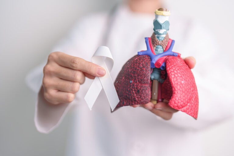 Lung Cancer Surgery in Seoul, South Korea by Asan Medical Center
