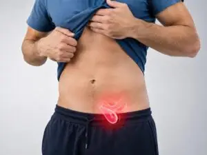 Hernia Surgery in Istanbul, Turkey by Avicenna Hospital at Avicenna Hospital — General Surgery Procedure Abroad