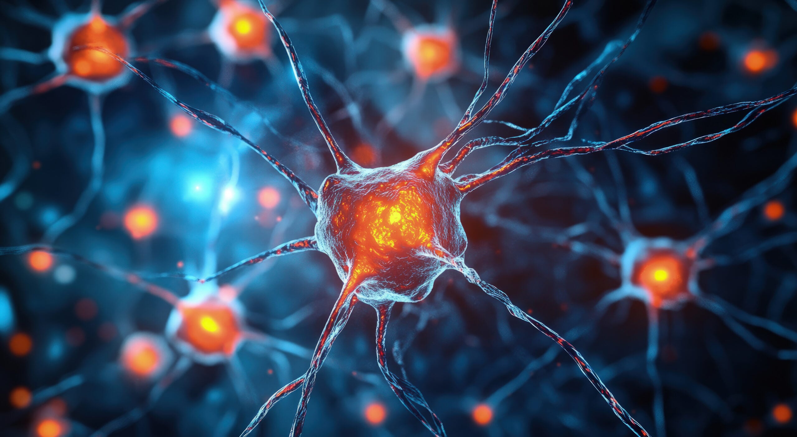 Huntington’s Disease (HD) Treatment with Stem Cells in Malacky, Slovakia by CellCenter Slovakia — Procedure Gallery Photo