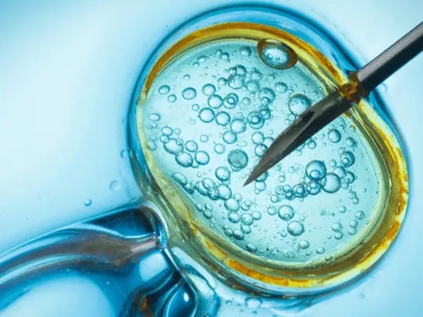 Low Ovarian Response Treatment in Athens, Greece by Ovagenesis — Fertility Procedure in Greece