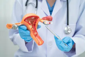 Premature Ovarian Failure Treatment Clinics and Procedures Abroad