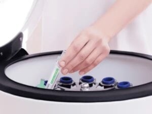 Ovarian Rejuvenation PRP Treatment for Low Ovarian Reserve in Athens, Greece by Ovagenesis — Fertility in Greece