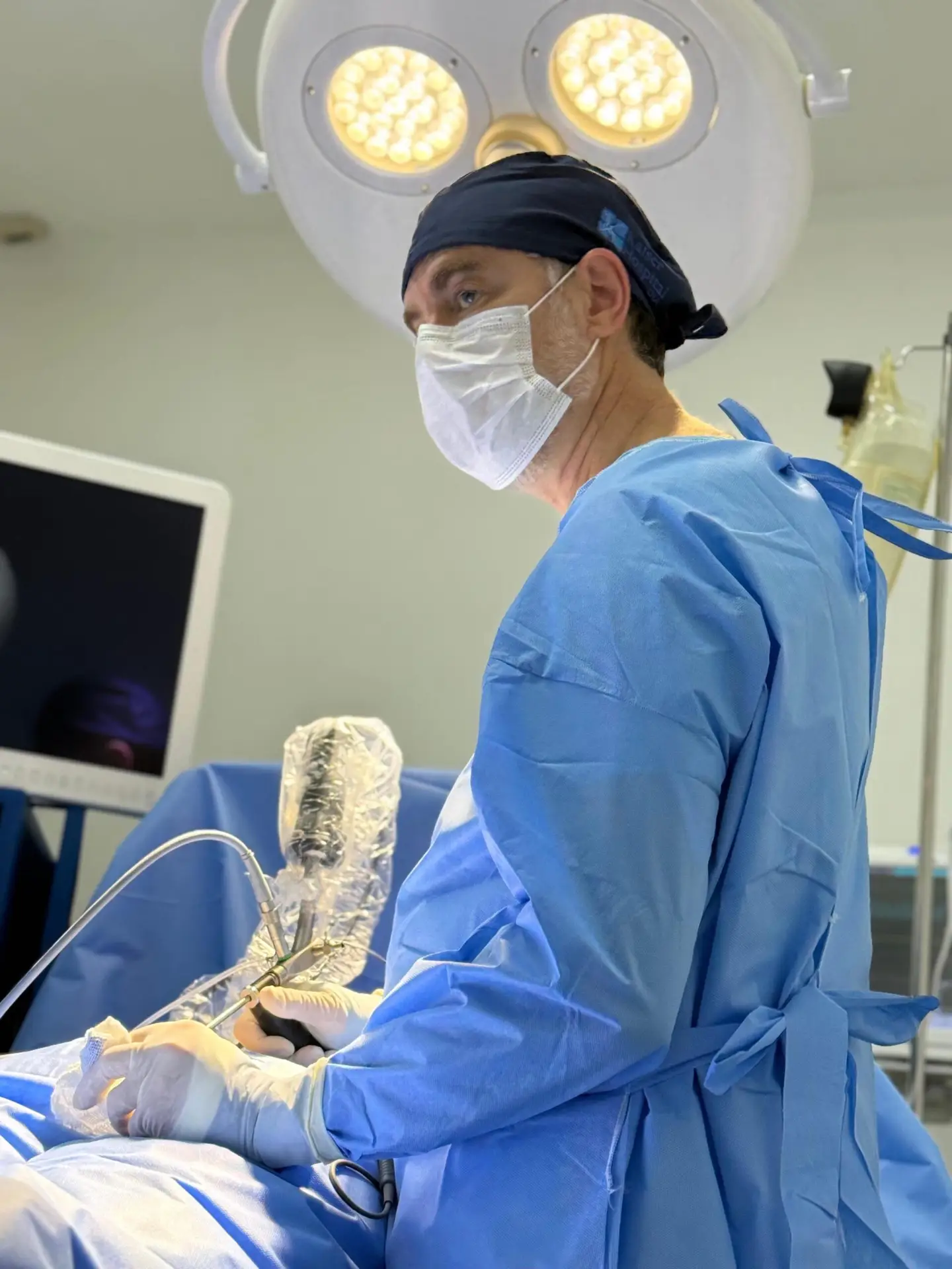 Pilonidal Cyst Surgery in Brazil by Dr. Kaiser Jr. — Procedure Gallery Photo