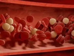 Peripheral Vascular Disease Surgery in Seoul, South Korea by Asan Medical Center at Asan Medical Center — Cardiology Procedure Abroad