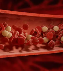 Peripheral Vascular Disease Surgery in Seoul, South Korea by Asan Medical Center