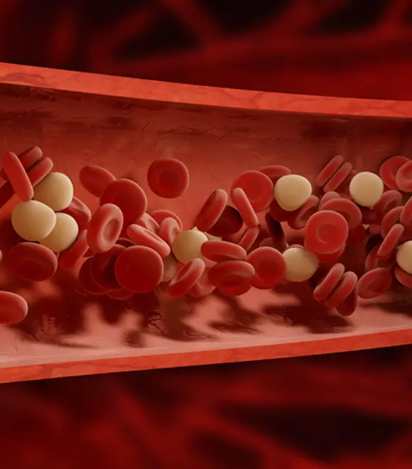 Peripheral Vascular Disease Surgery in Seoul, South Korea by Asan Medical Center