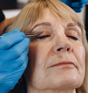 Blepharoplasty in Istanbul, Turkey by Esvita Clinic at Esvita Clinic — Plastic Surgery, Ophthalmology Procedure Abroad