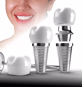 Dental Implants in Istanbul, Turkey by Esvita Clinic at Esvita Clinic — Dentistry Procedure Abroad