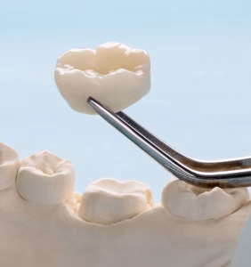 Emax Crowns in Istanbul, Turkey by Esvita Clinic at Esvita Clinic — Dentistry Procedure Abroad