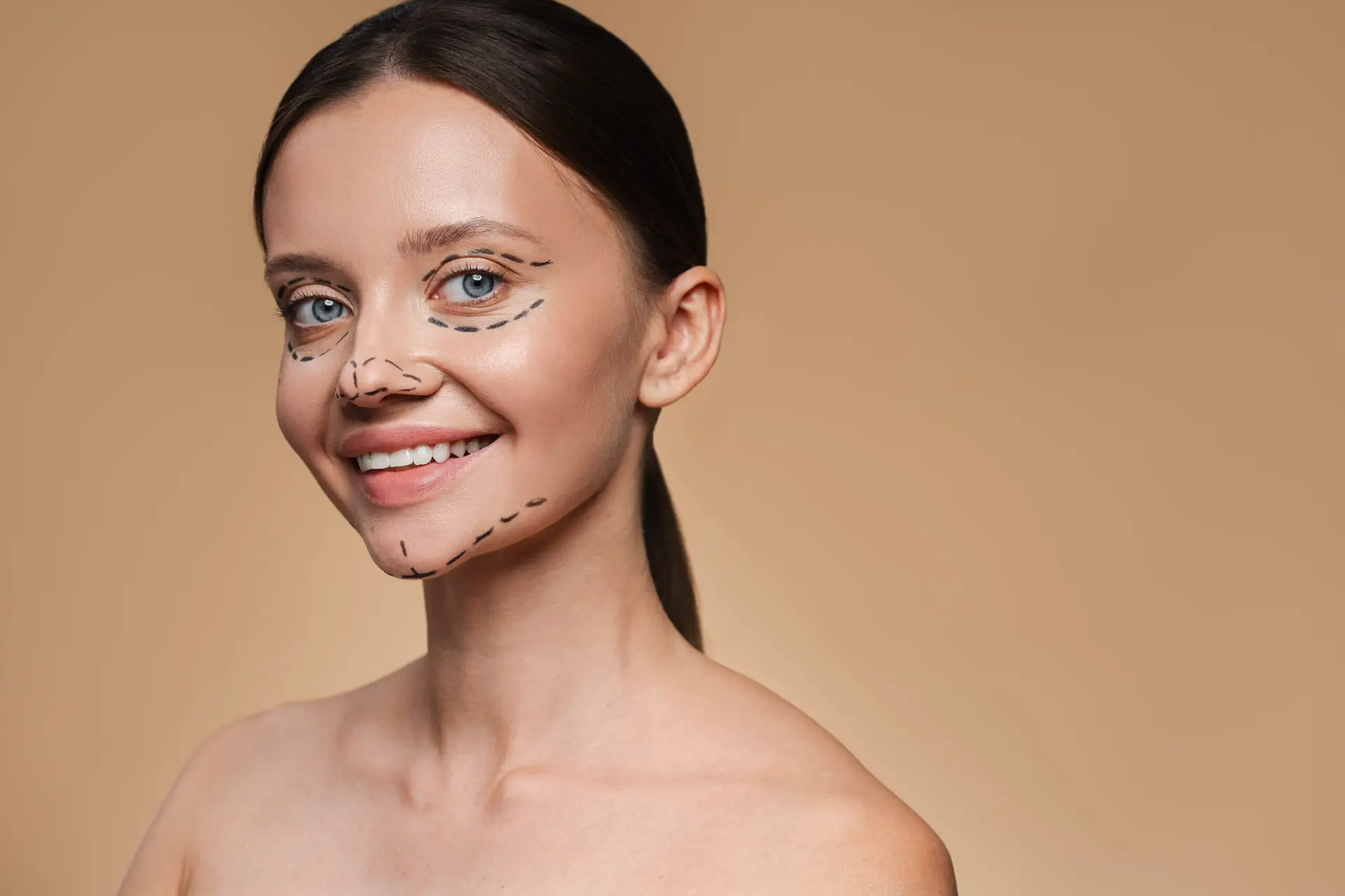 Face Lift in Istanbul, Turkey by Esvita Clinic — Procedure Gallery Photo