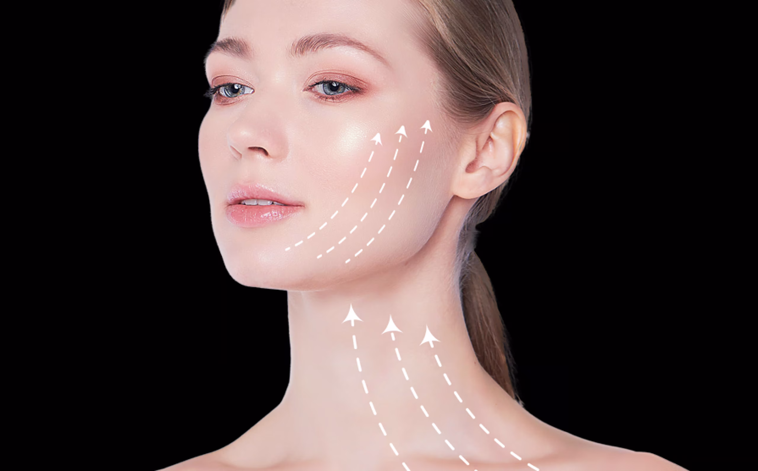 Face Lift in Istanbul, Turkey by Esvita Clinic — Procedure Gallery Photo