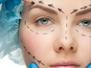 Facial Contouring Surgery in Seoul, South Korea by Asan Medical Center at Asan Medical Center — Plastic Surgery Procedure Abroad