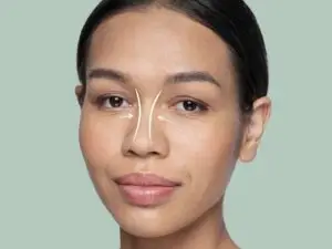Rhinoplasty in Seoul, South Korea by Asan Medical Center at Asan Medical Center — Plastic Surgery Procedure Abroad