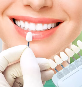 Zirconium Crowns in Istanbul, Turkey by Esvita Clinic at Esvita Clinic — Dentistry Procedure Abroad