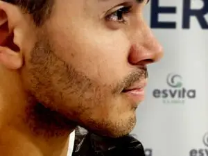 Beard Transplant in Istanbul, Turkey by Esvita Clinic — Hair Restoration Surgery in Turkey