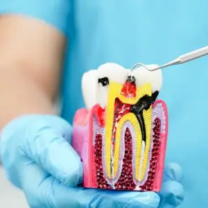 Endodontics Clinics and Procedures Abroad