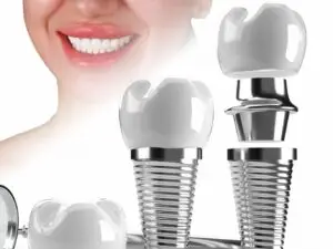 Dental Implants in Istanbul, Turkey by Esvita Clinic — Dentistry in Turkey