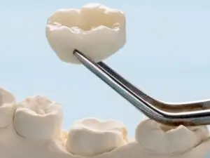 Emax Crowns in Istanbul, Turkey by Esvita Clinic — Dentistry in Turkey