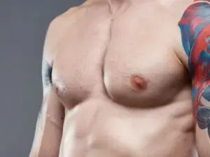 Gynecomastia in Istanbul, Turkey by Esvita Clinic — Plastic Surgery in Turkey