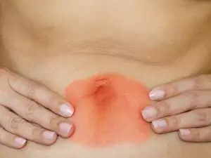 Laparoscopic Surgery for Hernias in Brazil by Dr. Kaiser Jr. at Dr. Kaiser Jr. — General Surgery Procedure Abroad