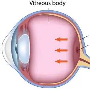 Macular Hole Clinics and Procedures Abroad