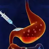 Stomach Botox Clinics and Procedures Abroad