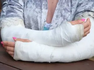 Simple and Complex Fracture Management in San José, Costa Rica by Dr. Aria Alexander Ravery Morovati at Dr. Aria Alexander Ravery Morovati — Orthopedics Procedure Abroad