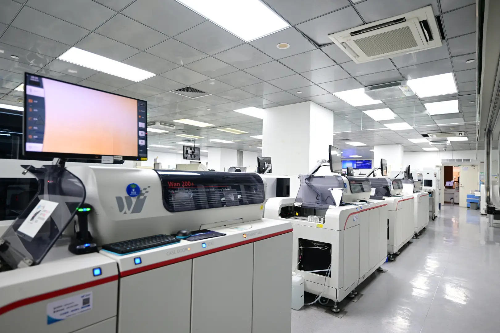 Extracorporeal Shock Wave Lithotripsy in Xiamen, China by Xiamen Humanity Hospital — Procedure Gallery Photo