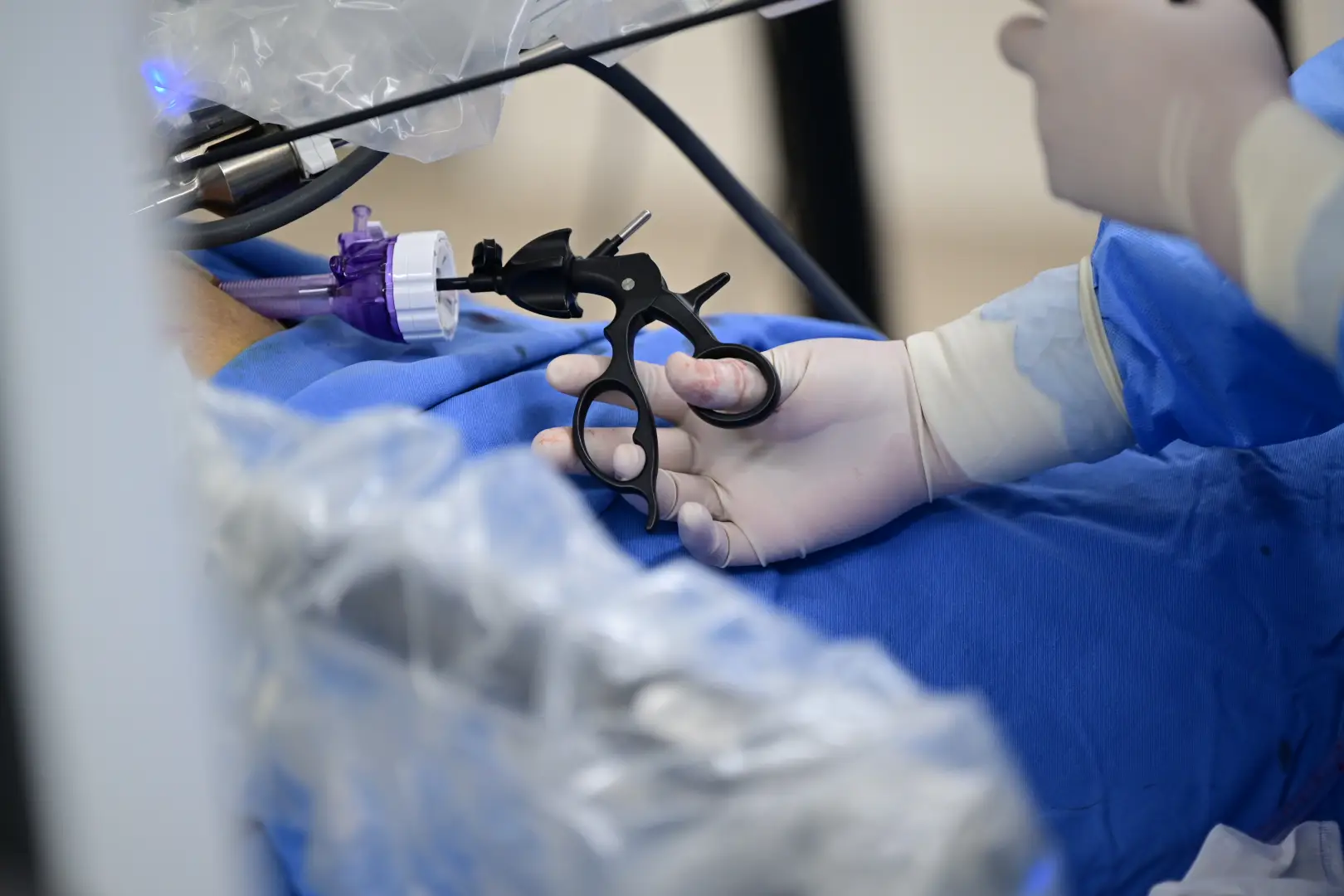 Extracorporeal Shock Wave Lithotripsy in Xiamen, China by Xiamen Humanity Hospital — Procedure Gallery Photo