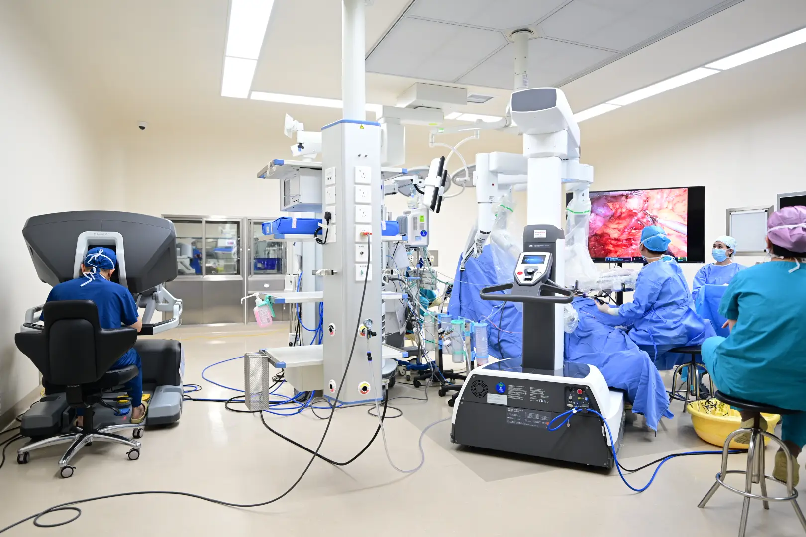 Extracorporeal Shock Wave Lithotripsy in Xiamen, China by Xiamen Humanity Hospital — Procedure Gallery Photo