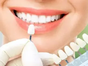 Zirconium Crowns in Istanbul, Turkey by Esvita Clinic at Esvita Clinic — Dentistry Procedure Abroad
